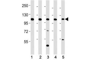 Western blot testing of Mertk antibody at 1:2000 dilution. (MERTK 抗体  (C-Term))