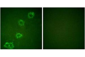 Immunofluorescence analysis of HuvEc cells, using BACE (Ab-498) Antibody. (BACE1 抗体  (AA 452-501))