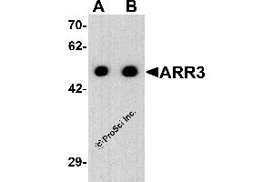 Western Blotting (WB) image for anti-Arrestin 3, Retinal (X-Arrestin) (ARR3) (C-Term) antibody (ABIN2457884) (ARR3 抗体  (C-Term))