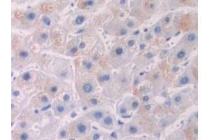 DAB staining on IHC-P; Samples: Human Liver Tissue (OTUB1 抗体  (AA 1-271))