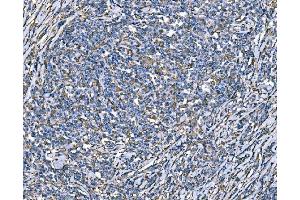 IHC analysis of SOD2 using anti-SOD2 antibody (ABIN7602799). (SOD2 抗体  (C-Term))