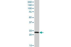 PCTP monoclonal antibody (M03), clone 3A11. (PCTP 抗体  (AA 106-214))