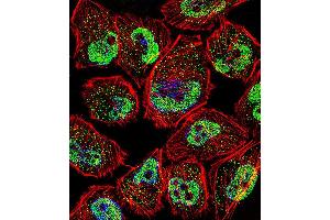 Fluorescent confocal image of U251 cell stained with KLF5 Antibody . (KLF5 抗体  (C-Term))