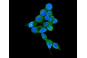 IF analysis of COMT using anti-COMT antibody (ABIN7601948).