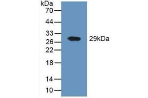 Detection of Recombinant DPP4, Human using Polyclonal Antibody to Cluster Of Differentiation 26 (CD26) (DPP4 抗体  (AA 484-728))