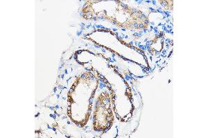 Immunohistochemistry of paraffin-embedded Mouse kidney using /// Rabbit pAb (ABIN7265627) at dilution of 1:50 (40x lens). (ANT1+ANT2+ANT3+ANT4 (C-Term) 抗体)