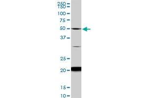 NADK monoclonal antibody (M01), clone 5F4. (NADK 抗体  (AA 1-446))