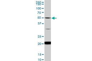 NADK monoclonal antibody (M01), clone 5F4.
