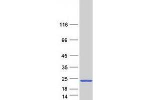 Validation with Western Blot
