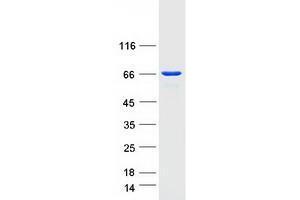 Western Blotting (WB) image for UTP6, Small Subunit (SSU) Processome Component, Homolog (UTP6) protein (Myc-DYKDDDDK Tag) (ABIN2735154)