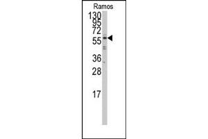 Image no. 1 for anti-Interferon Regulatory Factor 5 (IRF5) (N-Term) antibody (ABIN357996) (IRF5 抗体  (N-Term))