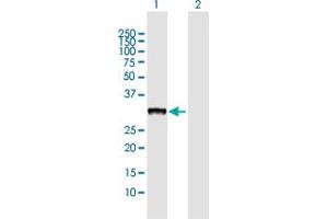 Western Blot analysis of CBR3 expression in transfected 293T cell line by CBR3 MaxPab polyclonal antibody. (CBR3 抗体  (AA 1-277))