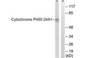 Western blot analysis of extracts from JurKat cells, using Cytochrome P450 24A1 Antibody. (CYP24A1 抗体  (AA 411-460))