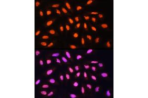Immunofluorescence analysis of U-2 OS cells using KA Rabbit pAb (ABIN1679964, ABIN5664011, ABIN5664013 and ABIN6219456) at dilution of 1:100 (40x lens). (KAT2A 抗体  (AA 1-100))