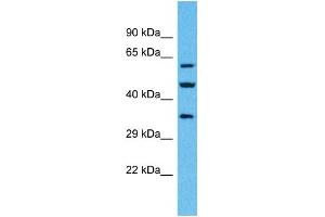 Western Blotting (WB) image for anti-Olfactory Receptor, Family 4, Subfamily F, Member 6 (OR4F6) (C-Term) antibody (ABIN2791737) (OR4F6 抗体  (C-Term))