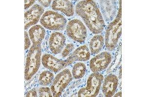 Immunohistochemistry (IHC) image for anti-Chromosome 9 Open Reading Frame 72 (C9ORF72) (AA 1-230) antibody (ABIN7266391)