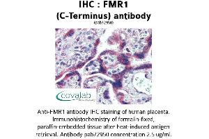 Image no. 1 for anti-Fragile X Mental Retardation 1 (FMR1) (C-Term), (Internal Region) antibody (ABIN1734384) (FMR1 抗体  (C-Term, Internal Region))