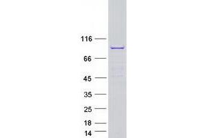 Western Blotting (WB) image for Sperm Associated Antigen 16 (SPAG16) (Transcript Variant 1) protein (Myc-DYKDDDDK Tag) (ABIN2732489)