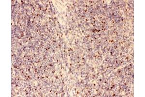 IHC-P: FOXP3 antibody testing of mouse spleen tissue