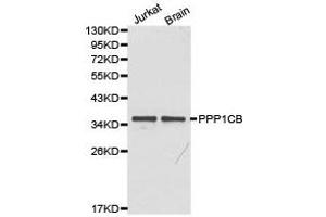 Western Blotting (WB) image for anti-Protein Phosphatase 1, Catalytic Subunit, beta Isoform (PPP1CB) antibody (ABIN1874218) (PPP1CB 抗体)
