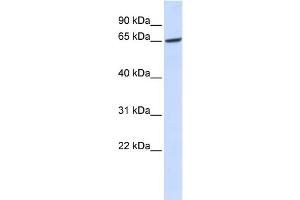 WB Suggested Anti-GPR177 Antibody Titration:  0.