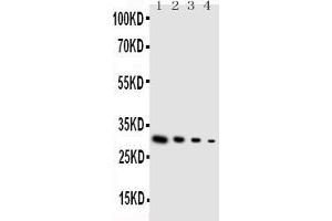 Western Blotting (WB) image for anti-Glial Cell Line Derived Neurotrophic Factor (GDNF) (AA 142-158), (Middle Region) antibody (ABIN3044406)