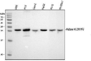 Western blot analysis of Histone H1.