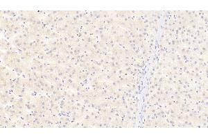 Detection of APOC3 in Human Liver Tissue using Polyclonal Antibody to Apolipoprotein C3 (APOC3) (APOC3 抗体  (AA 21-99))