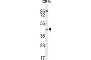 Western Blotting (WB) image for anti-Zinc Finger, MYND-Type Containing 10 (ZMYND10) (AA 328-356), (Middle Region) antibody (ABIN955675)