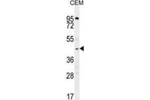 ZMYND10 Antibody (Center) western blot analysis in CEM cell line lysates (35 µg/lane). (ZMYND10 抗体  (Middle Region))