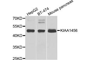 Western blot analysis of extracts of various cell lines, using KIAA1456 antibody (ABIN5974326) at 1/1000 dilution. (KIAA1456 抗体)
