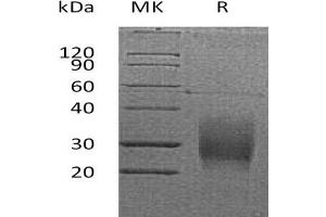 Western Blotting (WB) image for Tumor Necrosis Factor Receptor Superfamily, Member 10b (TNFRSF10B) protein (His tag,AVI tag) (ABIN7320862) (TNFRSF10B Protein (His tag,AVI tag))