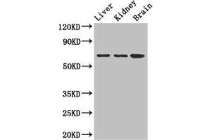 Western Blot Positive WB detected in: Mouse liver tissue, Mouse kidney tissue, Mouse brain tissue All lanes: AK5 antibody at 2. (Adenylate Kinase 5 抗体  (AA 61-215))