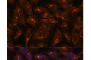Immunofluorescence analysis of U-2 OS cells using IFITM3 Polyclonal Antibody at dilution of 1:100. (IFITM3 抗体)