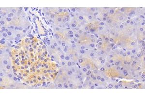 Detection of TF in Mouse Pancreas Tissue using Polyclonal Antibody to Tissue Factor (TF)