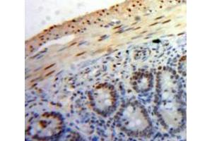 Used in DAB staining on fromalin fixed paraffin-embedded Bowels tissue (PPID 抗体  (AA 9-189))