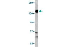 Western blot analysis of K-562 cell lysate (35 ug/lane) with PIK3CG polyclonal antibody . (PIK3 gamma 抗体  (C-Term))