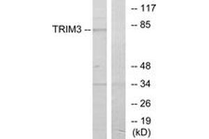 Western blot analysis of extracts from COLO cells, using TRIM3 Antibody. (TRIM3 抗体  (AA 1-50))