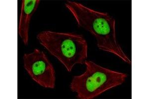 Fluorescent image of U251 cells stained with SUMO2/3 antibody. (SUMO2/3 抗体  (AA 49-81))