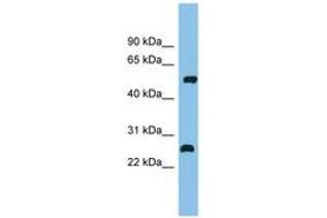 Image no. 1 for anti-Myocyte Enhancer Factor 2D (MEF2D) (C-Term) antibody (ABIN6744683) (MEF2D 抗体  (C-Term))