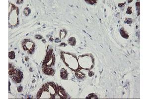 Image no. 10 for anti-Src-like-adaptor 2 (SLA2) antibody (ABIN1500949)