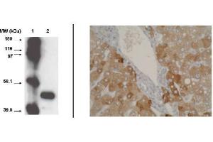 Immunohistochemistry (IHC) image for anti-Cytochrome P450, Family 2, Subfamily A, Polypeptide 6 (CYP2A6) (C-Term), (pSer472) antibody (ABIN264498) (CYP2A6 抗体  (C-Term, pSer472))