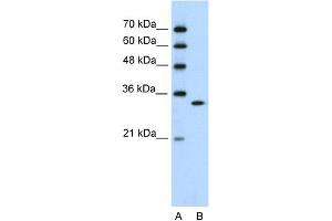WB Suggested Anti-RNASEH2A Antibody Titration:  0. (RNASEH2A 抗体  (C-Term))