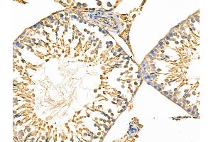ABIN6258818 and ABIN6274459 at 1/100 staining Rat testis tissue by IHC-P.