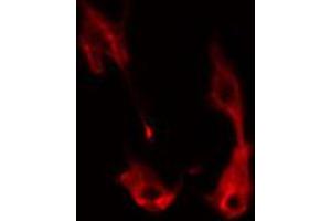 ABIN6274345 staining HeLa cells by IF/ICC. (ITPK1 抗体  (Internal Region))