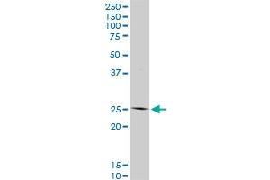 HOXC12 monoclonal antibody (M01), clone 1C6. (HOXC12 抗体  (AA 1-100))