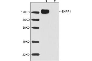 Western blot analysis of transfected HEK293 cell lysates using ENPP1 Antibody (ABIN398962, 1 µg/mL) Loading: Lane 1: Human ENPP1 expression in transfected HEK293 cell lysateLane 2: Non-transfected HEK293 cell lysateSecondary antibody: Donkey Anti-Goat IgG (H&L) [HRP] (ABIN398411, 1: 5,000) Predicted Size: 125 KD Observed Size: 125 KD (ENPP1 抗体  (C-Term))