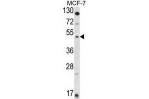 Western blot analysis of HSD11B2 in MCF-7 cell line lysates (35ug/lane).
