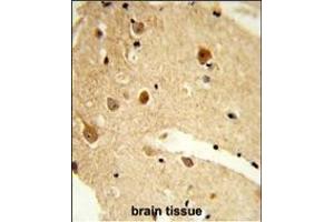 Formalin-fixed and paraffin-embedded human brain tissue reacted with CNDP1 Antibody (C-term), which was peroxidase-conjugated to the secondary antibody, followed by DAB staining. (CNDP1 抗体  (C-Term))