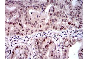 Immunohistochemistry (IHC) image for anti-Kinesin Family Member 22 (KIF22) antibody (ABIN969236)